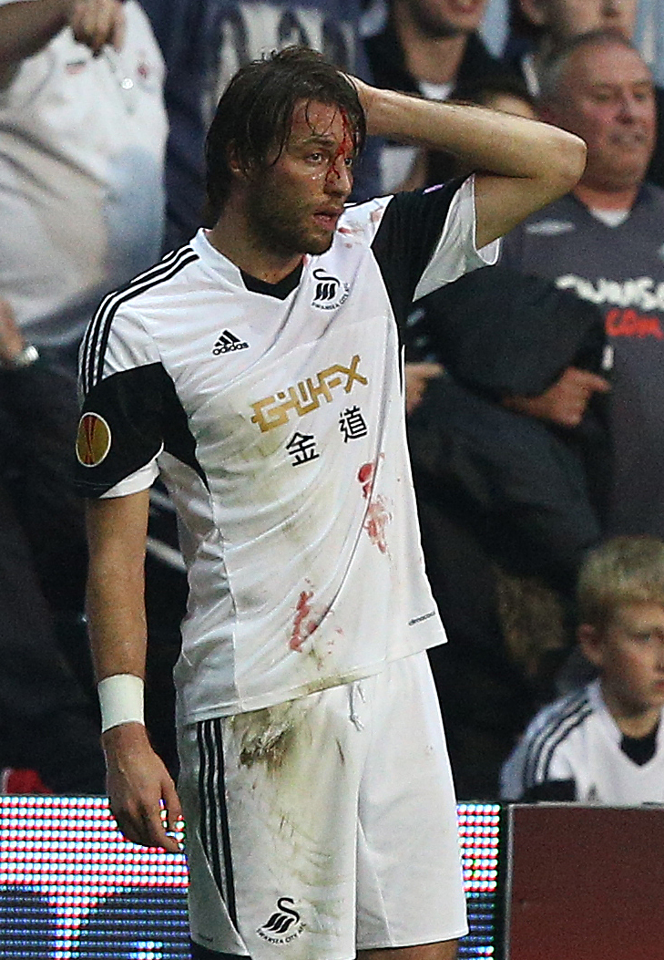 血流满面连换6件球衣战神米楚血战欧联图